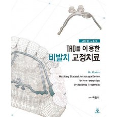 TAD를 이용한 비발치 교정치료