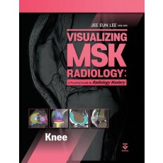 Visualizing MSK Radiology: A Practical Guide to Radiology Mastery